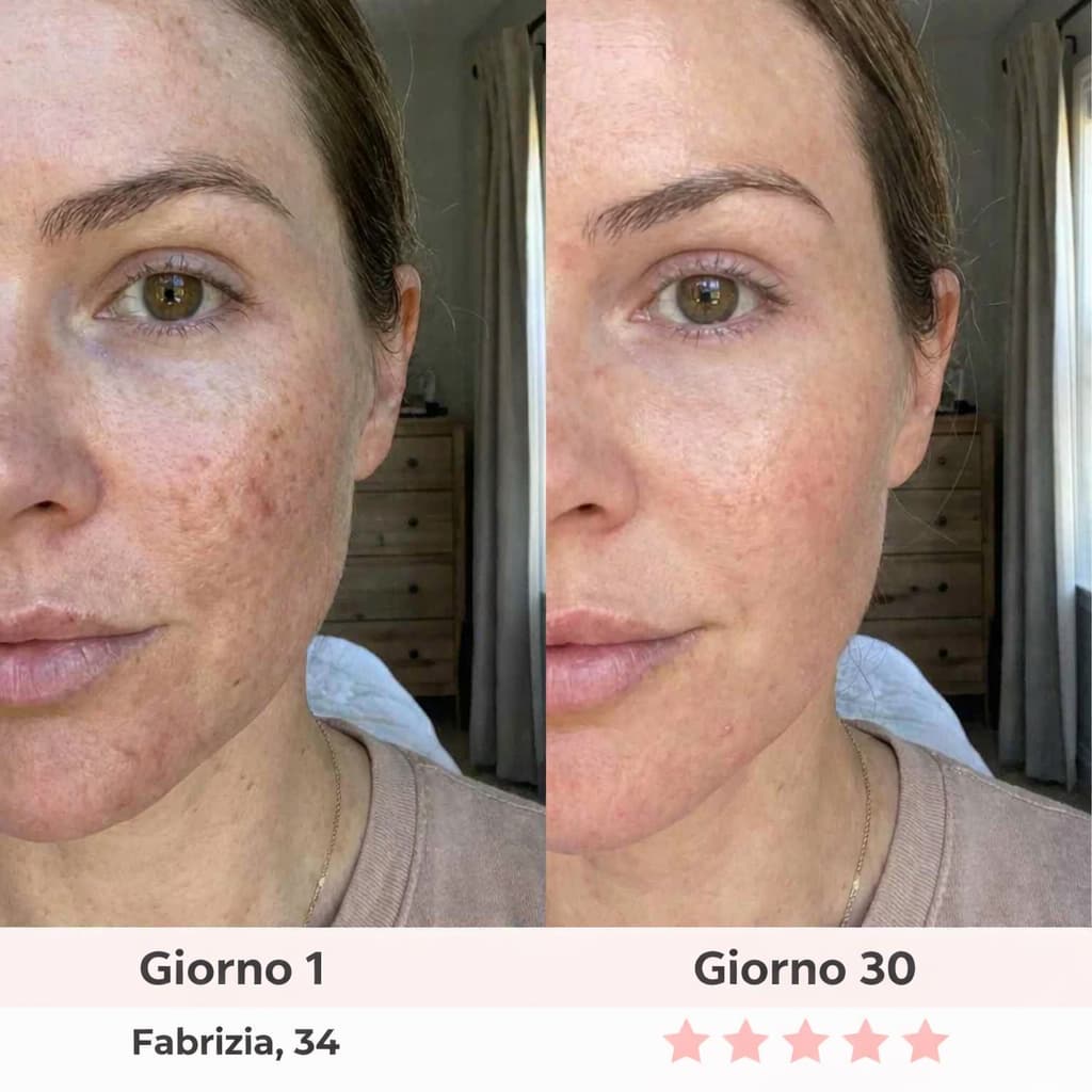 Solvery Glow™ — Dispositivo Professionale Viso | Luce Rossa + Vibrazioni · Clinicamente Testato